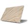 Burga Hardshell MacBook Air 13 Zoll (2022-2026) Hardcase Hülle MacBook Case - Full Glam - Model A2681 / A3113 / A3240 / A3449