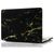 Mobigear Marble MacBook Pro 15 Zoll (2012-2015) Hardcase Hülle MacBook Case - Schwarz / Braun - Model A1398